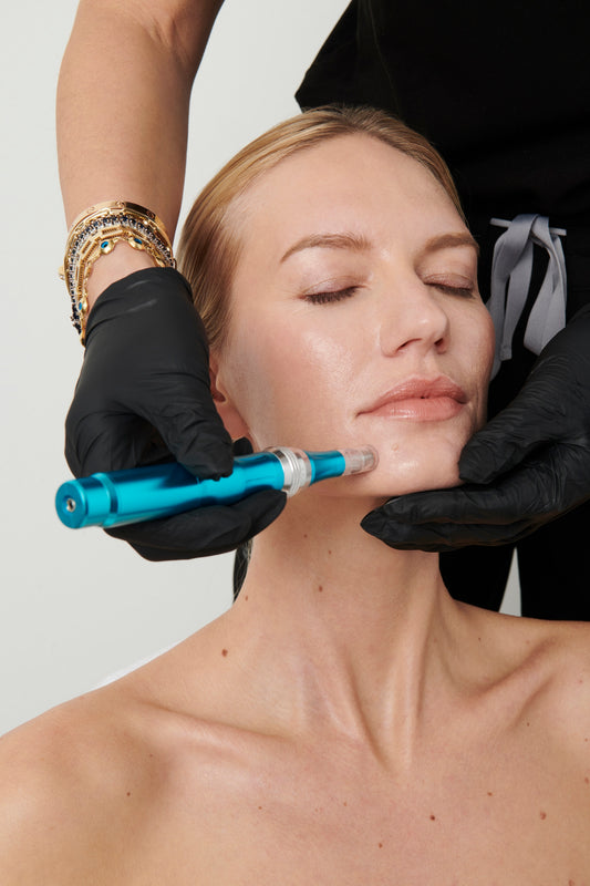 Genius RF Microneedling (3 Sessions)